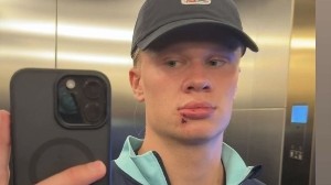 开云官网-【小吧社交秀】哈兰德帅脸惨遭“破相”  内维斯女友青春甜美